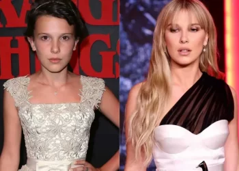 Millie Bobby Brown Look Before And After Plastic Surgery