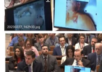 Paul Murdaugh Autopsy Photos & Report Death Graphic Obituary Body Photos