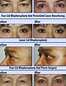 Images of Eyelid Surgery Covered by Insurance